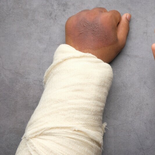 arm wrapped in bandage