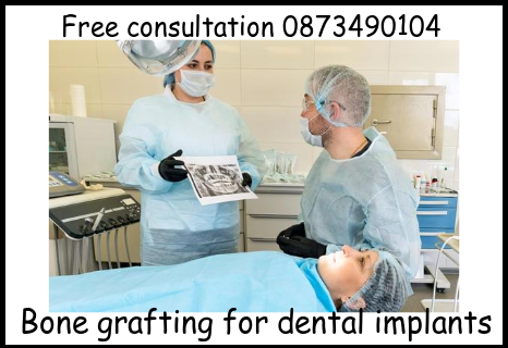 Bone grafting for dental implants image