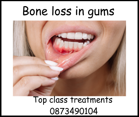 Bone loss in gums top class treatment image