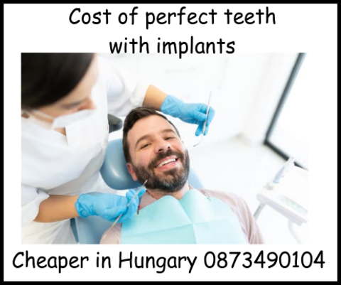 Cost of perfect teeth with implants image