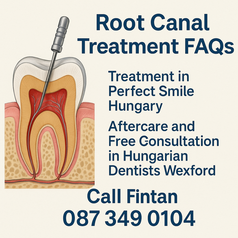 Root canal treatment FAQS 
