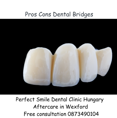 Pros cons dental bridges image