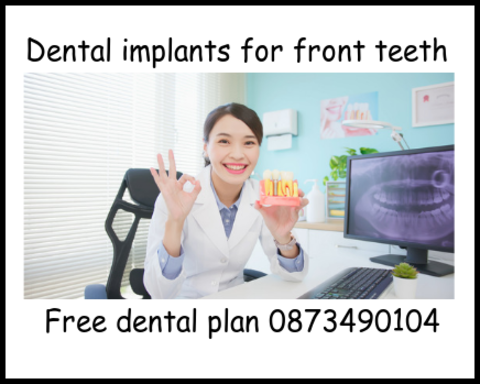 Dental implants for front teeth image 2