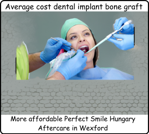 Average cost dental implant bone graft image