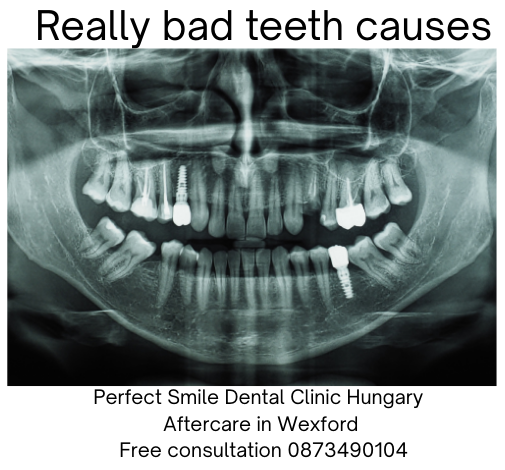 Really bad teeth causes image
