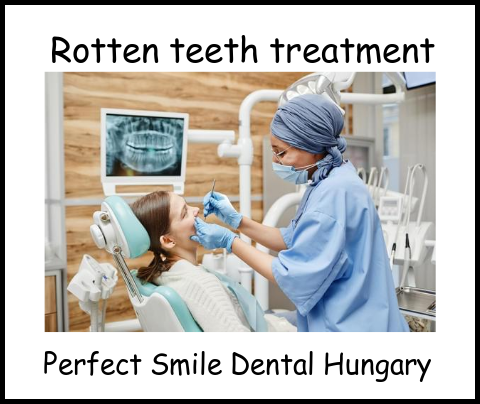 Rotten teeth treatment Perfect Smile dental clinic Hungary image