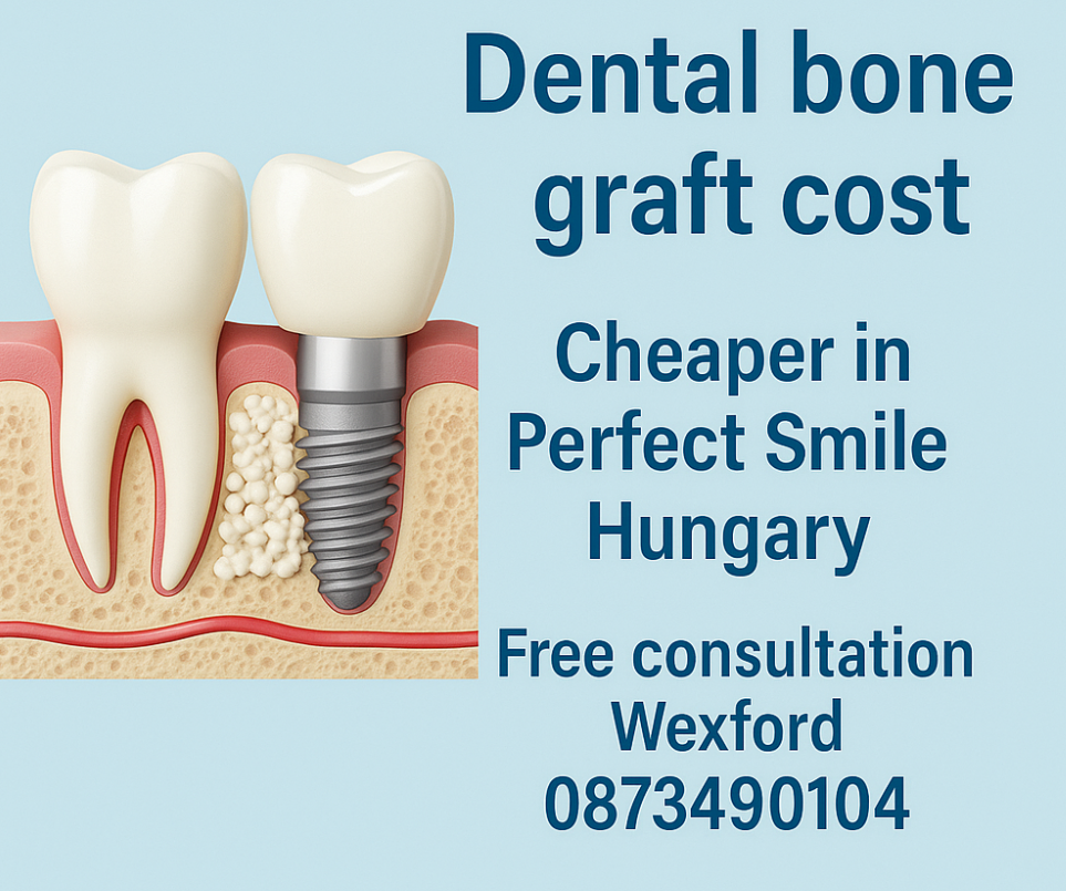 Dental bone graft cost image