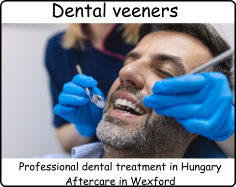 Dental veeners image