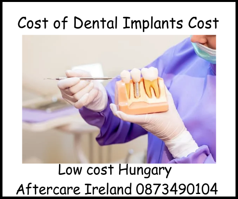 Cost of dental implants cost image