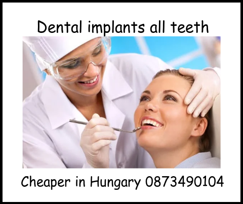 Dental implants all teeth image