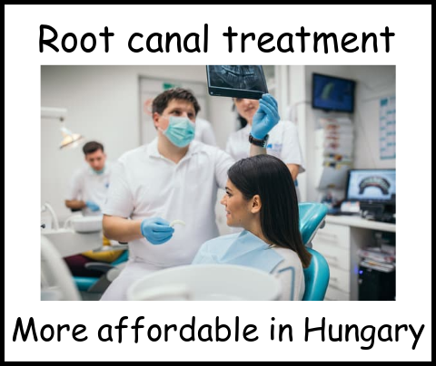 Root canal treatment more affordable in Hungary image