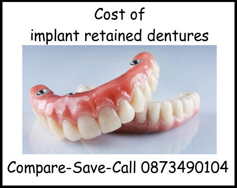 Cost of implant retained dentures image