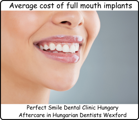 Average cost of full mouth implants image