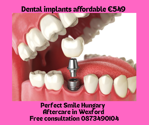 Dental implants affordable €549 image