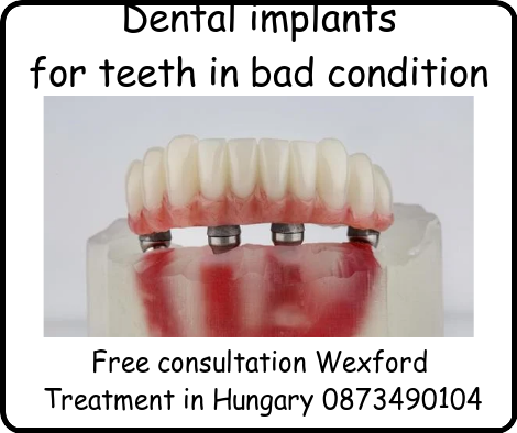 Dental implants for teeth in bad condition image 