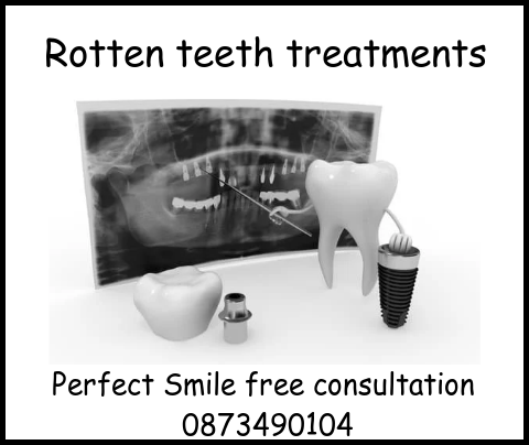 Rotten teeth treatments Perfect Smile dental clinic Hungary image