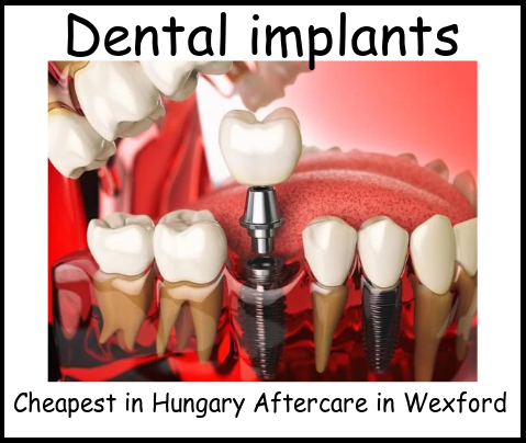 Dental implants image