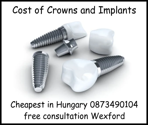 Cost of crowns and implants image