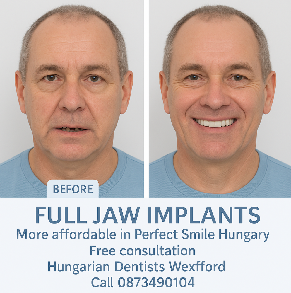 More affordable full jaw implants in Perfect Smile dental clinic Hungary image 