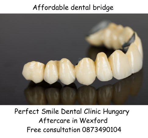 Affordable dental bridge image