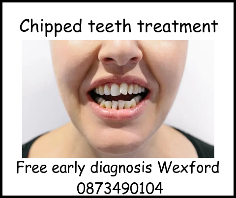 Chipped teeth treatment image