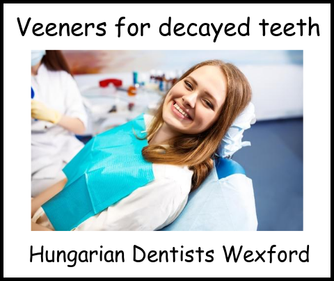 Veeners for decayed teeth 