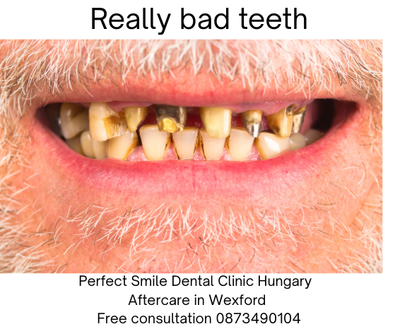 Really bad teeth image