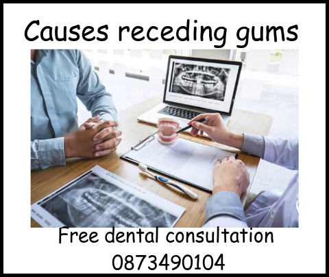 Causes receding gums image