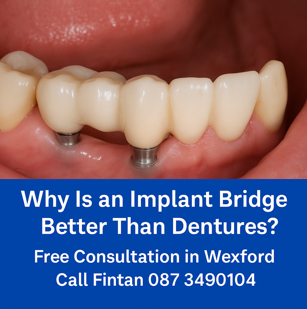 Why is an implant bridge better than dentures? image