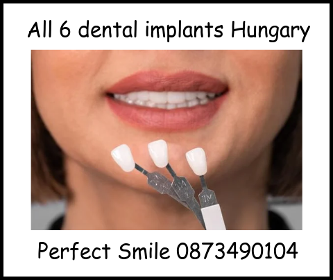 All 6 dental implants Hungary Perfect Smile image