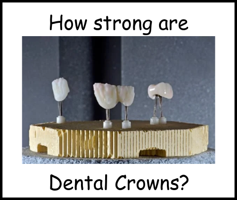 How strong are dental crowns image