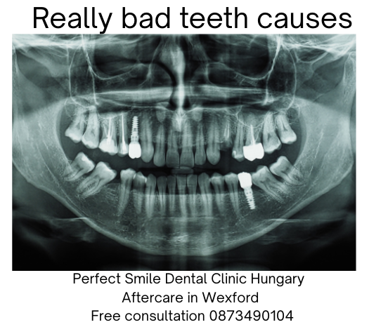 Really bad teeth causes image