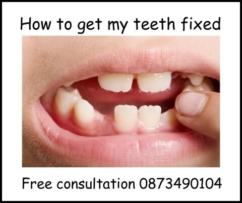 How to get my teeth fixed image