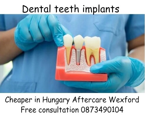 Dental teeth implants Perfect Smile Hungary image 