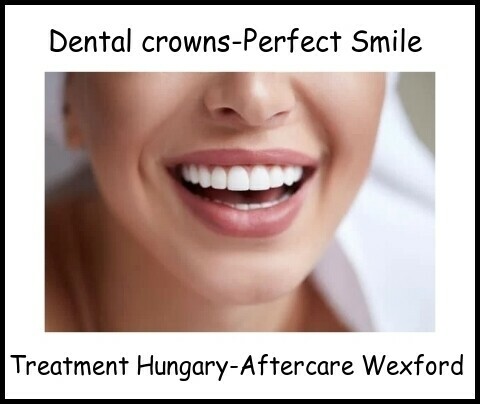 Dental crowns Perfect smile image