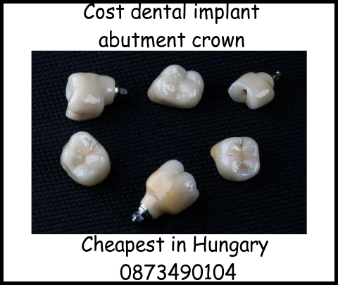 Cost dental implant abutment crown image