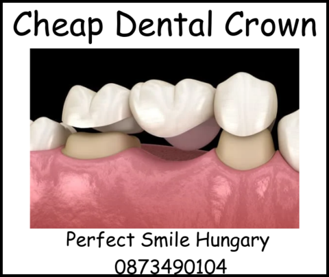 Cheap dental crowns image