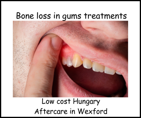 Bone loss in gums treatment Hungary image