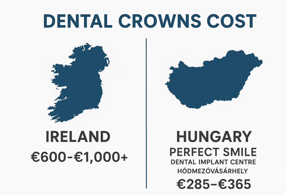 Dental crowns cost image