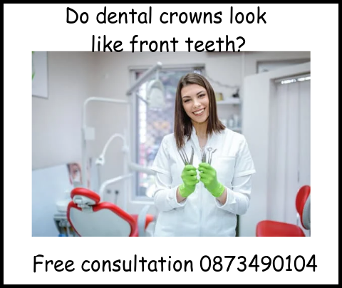 Do dental crowns look like front teeth image