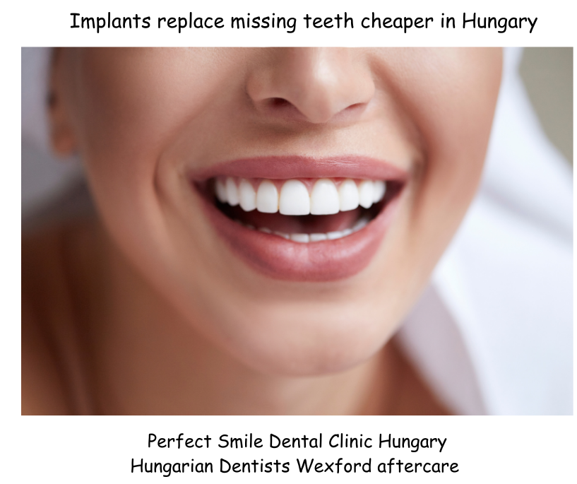 Implants for missing teeth cheaper in Hungary image