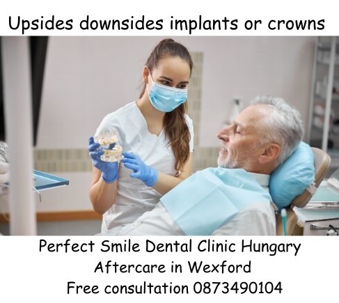 Upsides downsides implants or crowns image