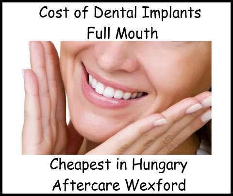 Cost of dental implants full mouth image 