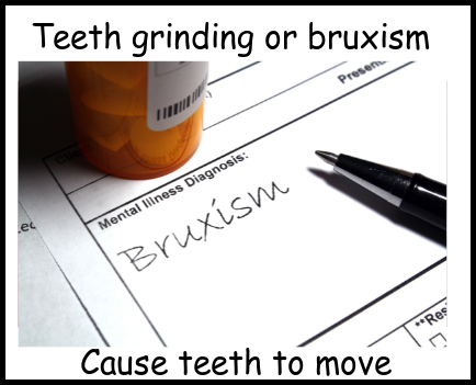 Teeth grinding or bruxism cause teeth to move image