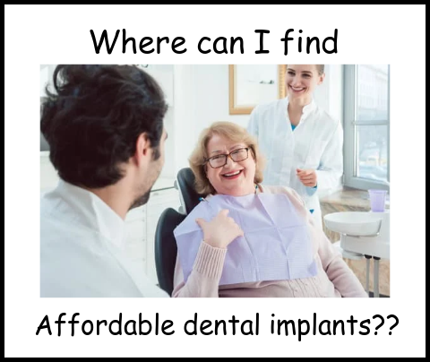 Where can I find affordable dental implants image