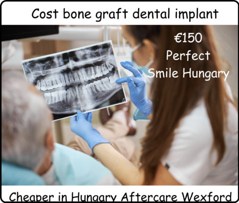 Cost bone graft dental implant image 1