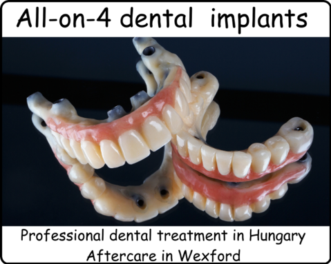 All on 4 dental implants image