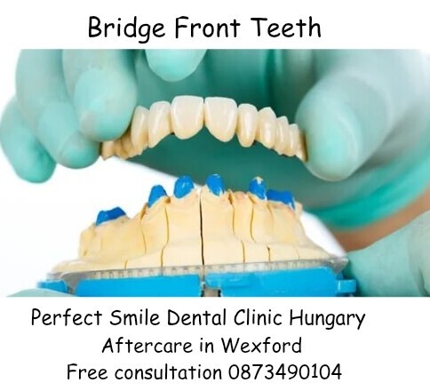 Bridge front teeth image