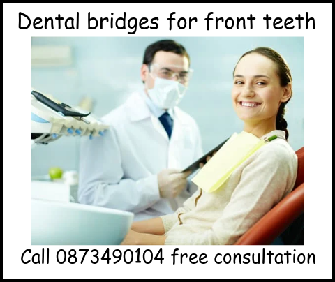 Dental bridges for front teeth image