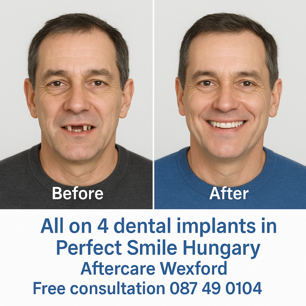 All on 4 dental implants in Perfect Smile dental clinic Hungary image 